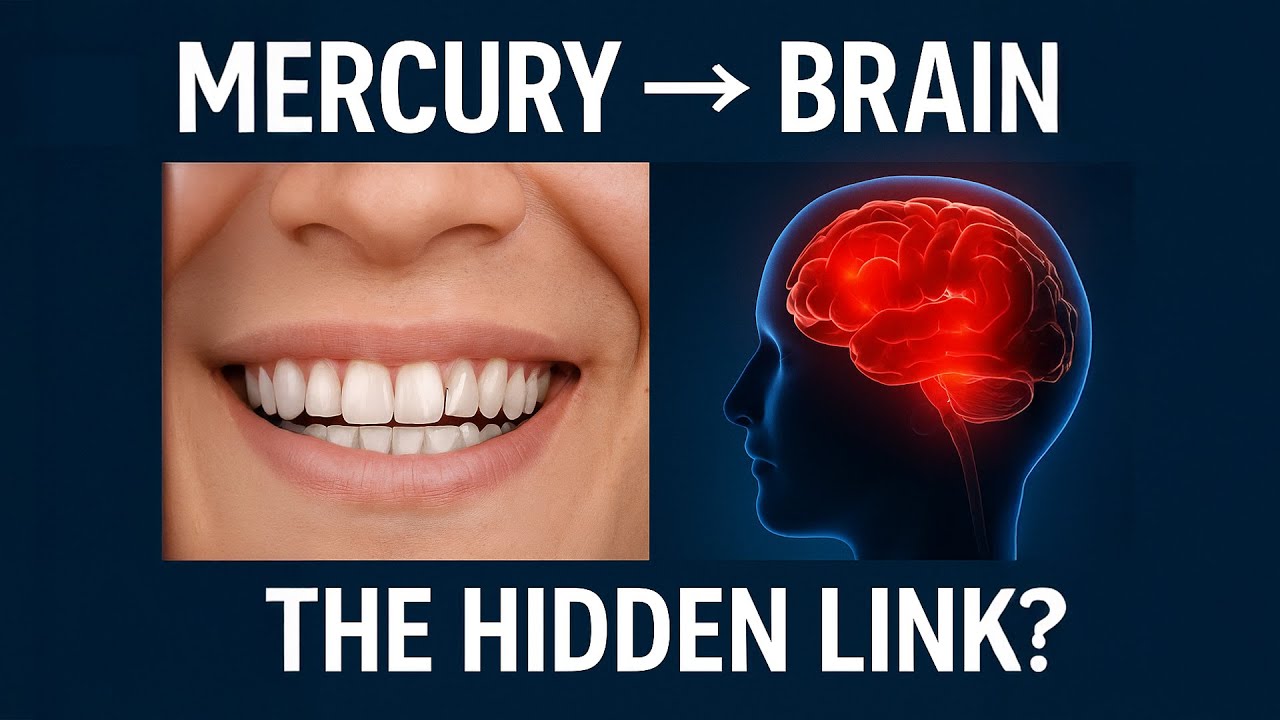Mercury Fillings & Multiple Sclerosis: The Hidden Connection Dentists Won’t Discuss